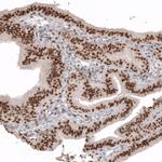 WT1 Antibody in Immunohistochemistry (Paraffin) (IHC (P))