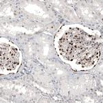 WT1 Antibody in Immunohistochemistry (Paraffin) (IHC (P))