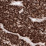 WT1 Antibody in Immunohistochemistry (Paraffin) (IHC (P))