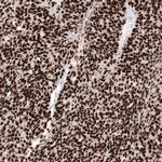 WT1 Antibody in Immunohistochemistry (Paraffin) (IHC (P))