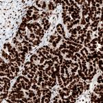 WT1 Antibody in Immunohistochemistry (Paraffin) (IHC (P))