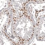 WT1 Antibody in Immunohistochemistry (Paraffin) (IHC (P))