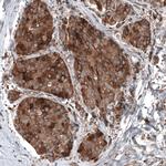 GSPT1 Antibody in Immunohistochemistry (Paraffin) (IHC (P))