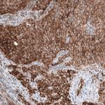 GSPT1 Antibody in Immunohistochemistry (Paraffin) (IHC (P))