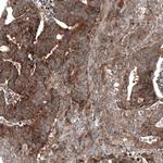 GSPT1 Antibody in Immunohistochemistry (Paraffin) (IHC (P))