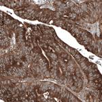 GSPT1 Antibody in Immunohistochemistry (Paraffin) (IHC (P))