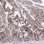 GSPT1 Antibody in Immunohistochemistry (Paraffin) (IHC (P))