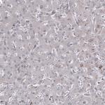 GSPT1 Antibody in Immunohistochemistry (Paraffin) (IHC (P))