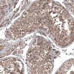 GSPT1 Antibody in Immunohistochemistry (Paraffin) (IHC (P))