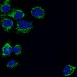 TSPO Antibody in Immunocytochemistry (ICC/IF)