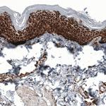 TSPO Antibody in Immunohistochemistry (Paraffin) (IHC (P))