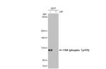 Phospho-FAK (Tyr576) Antibody in Western Blot (WB)