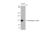 Phospho-FAK (Tyr576) Antibody in Western Blot (WB)