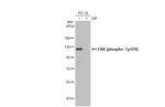 Phospho-FAK (Tyr576) Antibody in Western Blot (WB)