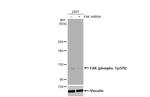 Phospho-FAK (Tyr576) Antibody in Western Blot (WB)