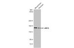 nNOS Antibody in Western Blot (WB)