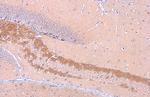 C9orf72 Antibody in Immunohistochemistry (Paraffin) (IHC (P))