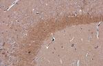 C9orf72 Antibody in Immunohistochemistry (Paraffin) (IHC (P))