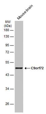 C9orf72 Antibody in Western Blot (WB)