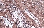 Vinculin Antibody in Immunohistochemistry (Paraffin) (IHC (P))