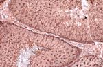 Vinculin Antibody in Immunohistochemistry (Paraffin) (IHC (P))