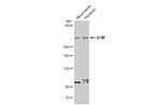 ATM Antibody in Western Blot (WB)