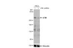 ATM Antibody in Western Blot (WB)