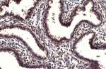 POLR2B Antibody in Immunohistochemistry (Paraffin) (IHC (P))