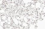 POLR2B Antibody in Immunohistochemistry (Paraffin) (IHC (P))