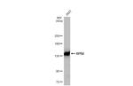 POLR2B Antibody in Western Blot (WB)