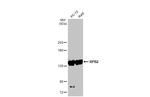 POLR2B Antibody in Western Blot (WB)