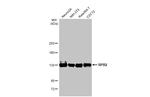 POLR2B Antibody in Western Blot (WB)