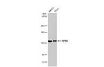 POLR2B Antibody in Western Blot (WB)