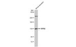 POLR2B Antibody in Western Blot (WB)