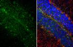 Somatostatin Antibody in Immunohistochemistry (Paraffin) (IHC (P))