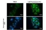 SQSTM1 Antibody in Immunocytochemistry (ICC/IF)