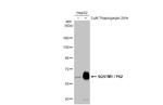 SQSTM1 Antibody in Western Blot (WB)