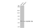 SQSTM1 Antibody in Western Blot (WB)