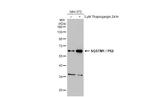 SQSTM1 Antibody in Western Blot (WB)