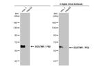 SQSTM1 Antibody in Western Blot (WB)