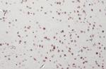 SMARCA2 Antibody in Immunohistochemistry (Paraffin) (IHC (P))