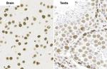 SMARCA2 Antibody in Immunohistochemistry (Paraffin) (IHC (P))