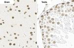 SMARCA2 Antibody in Immunohistochemistry (Paraffin) (IHC (P))