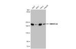 SMARCA2 Antibody in Western Blot (WB)