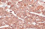 SDHA Antibody in Immunohistochemistry (Paraffin) (IHC (P))