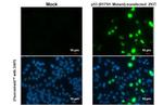 p53 (R175H Mutant) Antibody in Immunocytochemistry (ICC/IF)