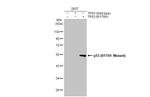 p53 (R175H Mutant) Antibody in Western Blot (WB)