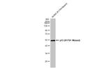 p53 (R175H Mutant) Antibody in Western Blot (WB)