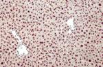 Glucocorticoid receptor (NR3C1) Antibody in Immunohistochemistry (Paraffin) (IHC (P))