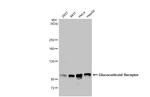 Glucocorticoid receptor (NR3C1) Antibody in Western Blot (WB)